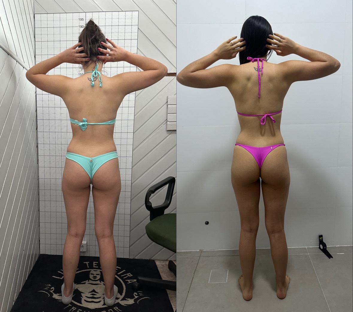 Antes e depois de Gabrielli L., 27 após a Fórmula do Glúteo Mágico